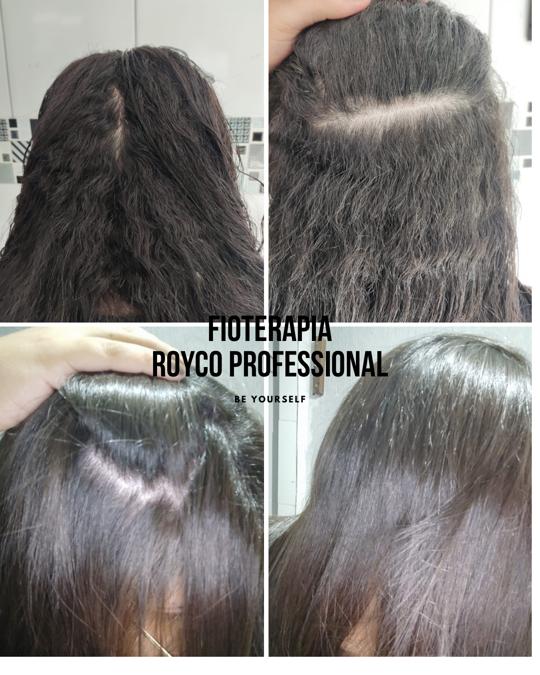 Royco Professional Fioterapia Keratin Hair Treatment - Queratina Para Alisar El Pelo, Cirugia Capilar, Queratina Organica Sem Formol, Keratin Hair Treatment Straightening Kit Vitamins Hair Mask